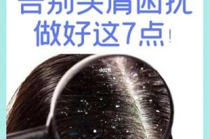 去头屑怎么办（头皮屑特别多怎么办）
