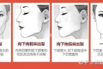 什么是颚骨宽（颚骨宽怎么办）