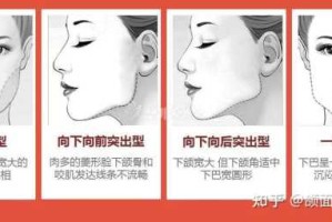 什么是颚骨宽（颚骨宽怎么办）