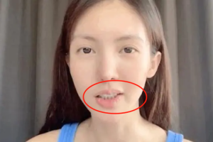 为什么有的女人嘴歪,美女怎么长的那么丑