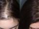 女孩头发稀少什么原因（女孩头发稀少什么原因）
