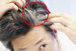 白头发是什么原因（白头发是什么原因引起的）