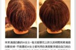 假发怎么挑（买假发时要怎样挑选）