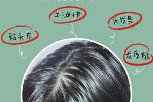 头太油怎么办（头太油了怎么办）