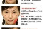 女性下巴长痘怎么调理（女性下巴长痘是身体哪出现问题）