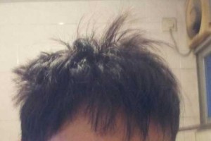 头发往上翘怎么办（头发往上翘怎么办压不下去）