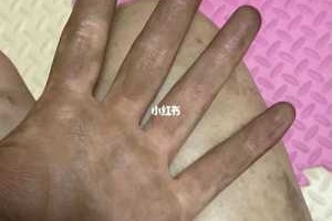 染头发弄到皮肤上怎么洗掉（染头膏弄到手上洗不掉咋办）