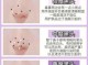 鼻子上的黑头怎么消除（去黑头的简单方法）