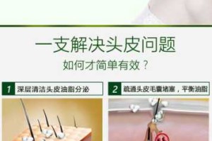 怎么保养头皮毛囊,怎么护理头发毛囊最有效