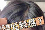 染发掉头发怎么办（染发掉头发怎么办?怎么治?）