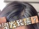 染发掉头发怎么办（染发掉头发怎么办?怎么治?）