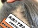 掉发很严重怎么办?如何治疗脱发,脱发怎么办呀.都成秃头了