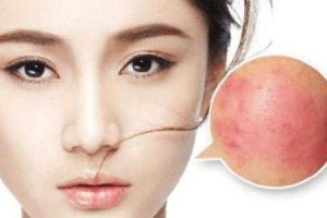 皮肤干燥起皮长痘痘怎么办（皮肤干燥起皮长痘痘怎么办图片）