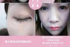 肿眼睛怎么贴双眼皮（肿眼睛怎么贴双眼皮贴）