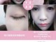 肿眼睛怎么贴双眼皮（肿眼睛怎么贴双眼皮贴）