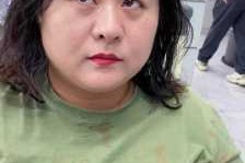 大圆脸怎么办（大圆脸怎么办很自卑）