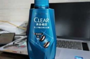 头油发干用什么洗发水,头油脱发用什么洗发水最好