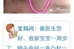 脑门凸怎么办（脑门有点凸）