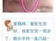 脑门凸怎么办（脑门有点凸）