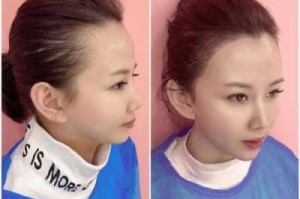 怎么让发际线长头发（怎么让发际线长头发:怎么才能长头发）