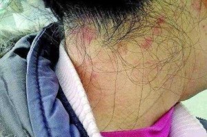 染发以后头皮痒怎么办（染头发头皮有刺激正常吗）