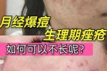 女生为什么会长痘痘（女生说最近长了好多痘怎么回）