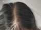女生掉头发比较厉害是什么原因（女生掉头发比较厉害是什么原因）