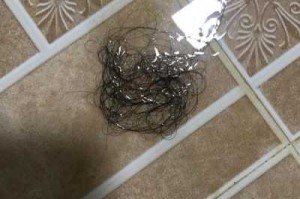 请问头发掉是什么原因（请问头发掉是什么原因引起的）