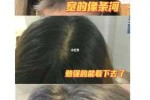 为什么身体上其它部位的毛长到一定程度就不再长，而头发却能不断长长,长头发适合什么发型男