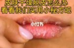 皮肤晒起皮了怎么办（皮肤晒起皮了怎么办小妙招）