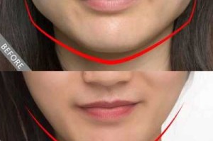 国字脸女生怎么瘦脸（国字脸瘦脸怎么办）