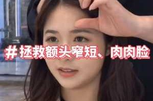 额头短窄怎么办（额头短窄怎么办是不是命也短）