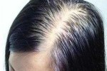 为什么头发长得很快（为什么头发长得很快还掉头发）