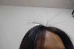 头发贴脸怎么办（头发静电贴脸怎么办）