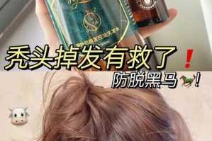 洗头发掉头发怎么办（为什么洗了洗发水后大量掉发怎么办）