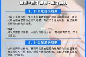 怎么祛白头（怎么祛白头与黑头粉刺）