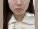 中年女性脸颊如何胖起来,脸颊怎么胖起来