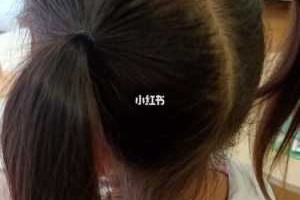 宝宝三岁了，现在头顶头发稀少，应该怎么办呢？还能长出头发吗,女的头发稀少什么原因造成的