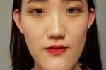 尖下巴什么样（怎样的下巴算是尖下巴）