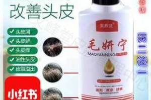 不洗头的情况下怎样快速清理头上的头皮屑,药店一种去头皮屑的药