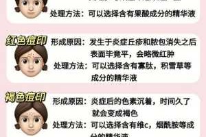 长痘痘怎么处理（长痘痘怎么处理不会留痘印）