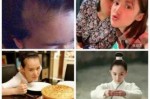 宝宝前面头发茂盛后面秃怎么办,生孩子后掉头发怎么办女性
