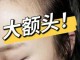 头发少发际线高怎么办（脑门秃发际线高怎么办）