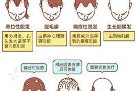 脱发的原因，脱发的治疗方法有哪些,脱发的主要原因是什么引起的