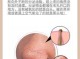 怎么消除黑头（怎么消除黑头毛孔粗大）