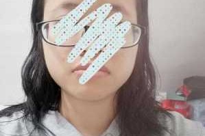 头发贴着头皮什么原因（头发贴着头皮怎么办?）