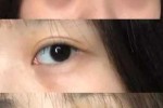 为什么会有黑眼圈和眼袋（为什么会有黑眼圈和眼袋怎么去除）