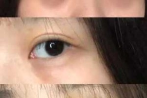 为什么会有黑眼圈和眼袋（为什么会有黑眼圈和眼袋怎么去除）
