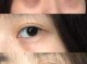 为什么会有黑眼圈和眼袋（为什么会有黑眼圈和眼袋怎么去除）