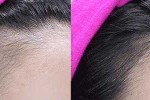 怎么长胎毛（怎么长胎毛发际线）